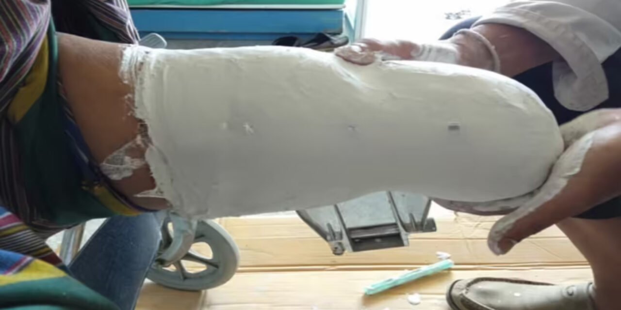 ವೈದ್ಯಕೀಯ ಸೀಟಿಗಾಗಿ ಕಾಲು ಕತ್ತರಿಸಿಕೊಂಡ ಯುವಕ – ಅಘಾತಕಾರಿ ಘಟನೆ