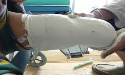 ವೈದ್ಯಕೀಯ ಸೀಟಿಗಾಗಿ ಕಾಲು ಕತ್ತರಿಸಿಕೊಂಡ ಯುವಕ – ಅಘಾತಕಾರಿ ಘಟನೆ